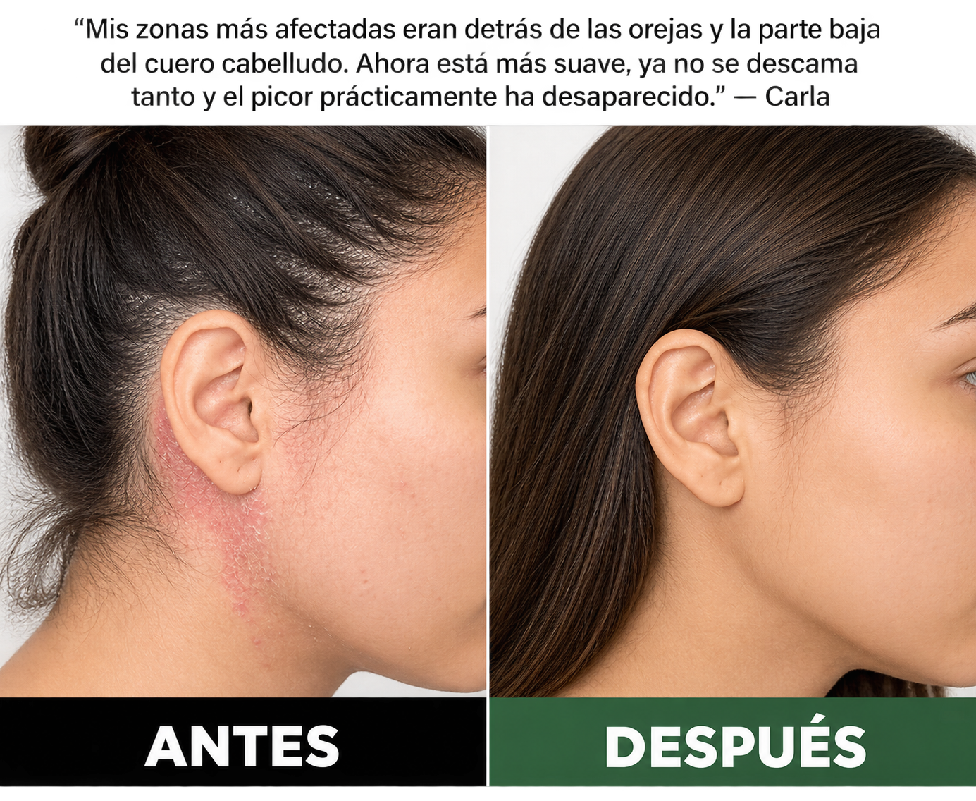 Exfoliante Capilar Natural Lurevia